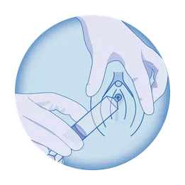 Icon showing application of gel to the female urethra