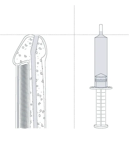 Filling volume of INSTILLAGEL® syringe compared to male urethra